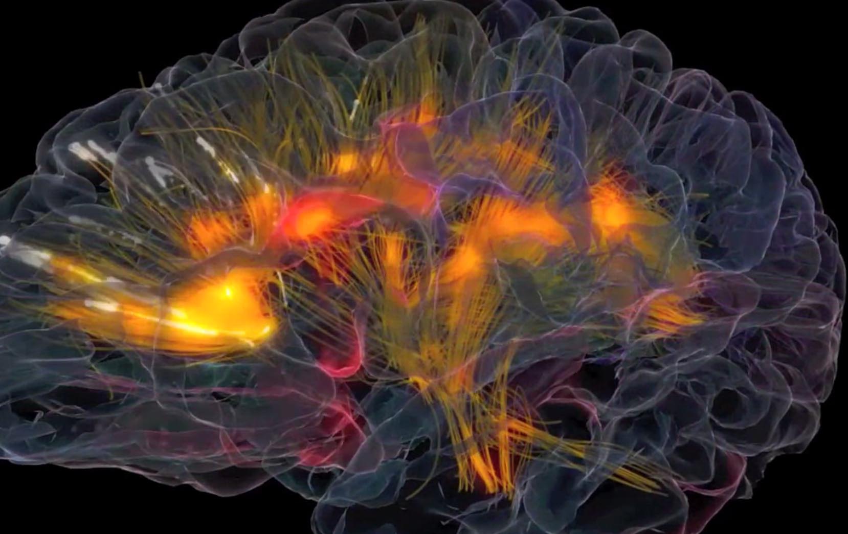 The Glass Brain